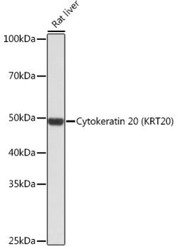 Invitrogen Cytokeratin 20 Recombinant Rabbit Monoclonal Antibody (8C6A3) 100 &mu;L | Buy Online | Invitrogen&trade; | Fisher Scientific