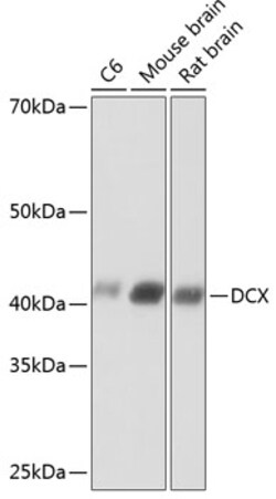 Invitrogen Doublecortin Recombinant Rabbit Monoclonal Antibody (6H1B3)