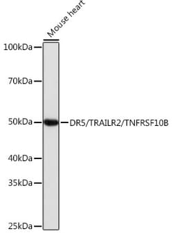 Invitrogen TRAIL-R2 (DR5) Recombinant Rabbit Monoclonal Antibody (8M7W1)