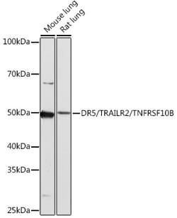 Invitrogen TRAIL-R2 (DR5) Recombinant Rabbit Monoclonal Antibody (8M7W1)