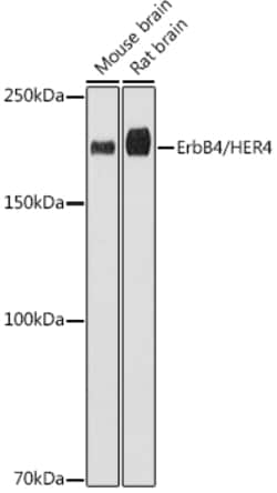 Invitrogen ErbB4 Recombinant Rabbit Monoclonal Antibody (8E5D0) 100 &mu;L;