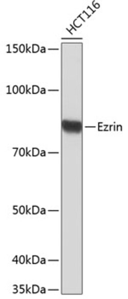 Invitrogen Ezrin Recombinant Rabbit Monoclonal Antibody (1L5O2) 100 &mu;L | Buy Online | Invitrogen&trade; | Fisher Scientific