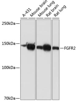 Invitrogen FGFR2 Recombinant Rabbit Monoclonal Antibody (0O6A9) 100 &mu;L;