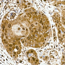 Invitrogen GAPDH Recombinant Rabbit Monoclonal Antibody (4A9L6) 100 &mu;L;