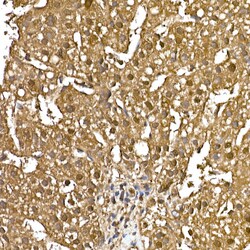 Invitrogen GAPDH Recombinant Rabbit Monoclonal Antibody (4A9L6) 100 &mu;L;