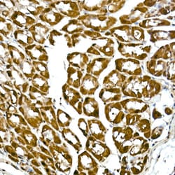 Invitrogen GAPDH Recombinant Rabbit Monoclonal Antibody (4A9L6) 100 &mu;L;