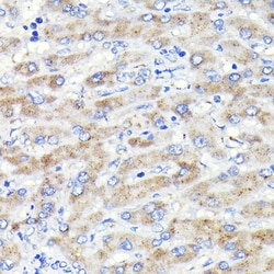 Invitrogen GBA Recombinant Rabbit Monoclonal Antibody (8O3Z7) 100 &mu;L | Buy Online | Invitrogen&trade; | Fisher Scientific