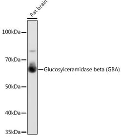 Invitrogen GBA Recombinant Rabbit Monoclonal Antibody (8O3Z7) 100 &mu;L | Buy Online | Invitrogen&trade; | Fisher Scientific