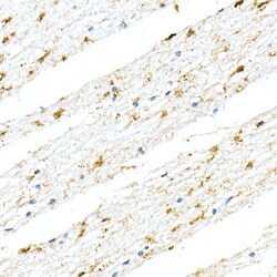 Invitrogen GFAP Recombinant Rabbit Monoclonal Antibody (8M2F9) 100 &mu;L | Buy Online | Invitrogen&trade; | Fisher Scientific