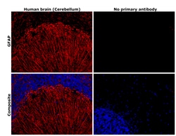 Invitrogen GFAP Recombinant Rabbit Monoclonal Antibody (8M2F9) 100 &mu;L | Buy Online | Invitrogen&trade; | Fisher Scientific