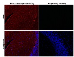 Invitrogen GFAP Recombinant Rabbit Monoclonal Antibody (8M2F9) 100 &mu;L | Buy Online | Invitrogen&trade; | Fisher Scientific