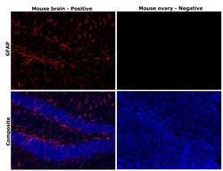 Invitrogen GFAP Recombinant Rabbit Monoclonal Antibody (8M2F9) 100 &mu;L | Buy Online | Invitrogen&trade; | Fisher Scientific