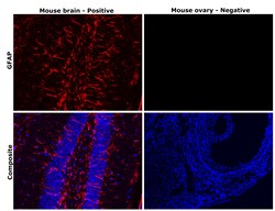 Invitrogen GFAP Recombinant Rabbit Monoclonal Antibody (8M2F9) 100 &mu;L | Buy Online | Invitrogen&trade; | Fisher Scientific