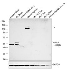 Invitrogen GFAP Recombinant Rabbit Monoclonal Antibody (8M2F9) 100 &mu;L | Buy Online | Invitrogen&trade; | Fisher Scientific