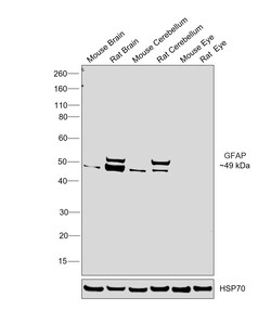 Invitrogen GFAP Recombinant Rabbit Monoclonal Antibody (8M2F9) 100 &mu;L | Buy Online | Invitrogen&trade; | Fisher Scientific