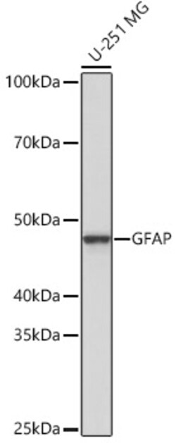 Invitrogen GFAP Recombinant Rabbit Monoclonal Antibody (8M2F9) 100 &mu;L | Buy Online | Invitrogen&trade; | Fisher Scientific