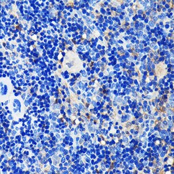 Invitrogen GRB2 Recombinant Rabbit Monoclonal Antibody (9K6H0) 100 &mu;L;