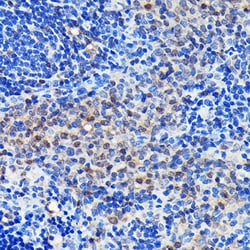 Invitrogen GRB2 Recombinant Rabbit Monoclonal Antibody (9K6H0) 100 &mu;L;