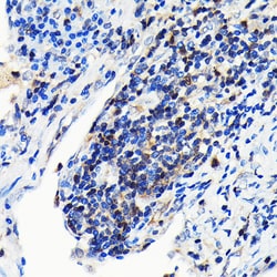 Invitrogen GRB2 Recombinant Rabbit Monoclonal Antibody (9K6H0) 100 &mu;L;