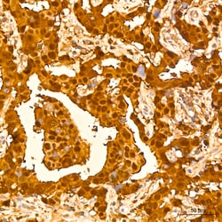 Invitrogen GSTP1 Recombinant Rabbit Monoclonal Antibody (6D8G7) 100 &mu;L;