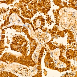 Invitrogen GSTP1 Recombinant Rabbit Monoclonal Antibody (6D8G7) 100 &mu;L;