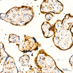 Invitrogen GSTP1 Recombinant Rabbit Monoclonal Antibody (6D8G7) 100 &mu;L;