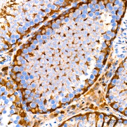 Invitrogen GSTP1 Recombinant Rabbit Monoclonal Antibody (6D8G7) 100 &mu;L;