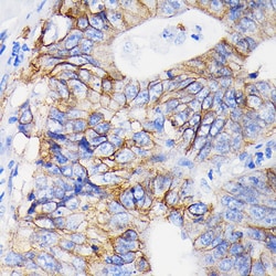 Invitrogen ITGA2 Recombinant Rabbit Monoclonal Antibody (7O9H6) 100 &mu;L;