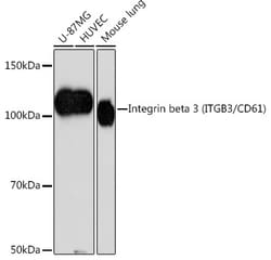 Invitrogen CD61 (Integrin beta 3) Recombinant Rabbit Monoclonal Antibody (7D5N1) 100 &mu;L | Buy Online | Invitrogen&trade; | Fisher Scientific