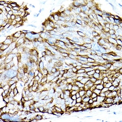 Invitrogen MUC1 Recombinant Rabbit Monoclonal Antibody (2M3D5) 100 &mu;L;