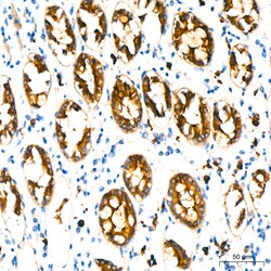 Invitrogen MUC1 Recombinant Rabbit Monoclonal Antibody (2M3D5) 100 &mu;L;