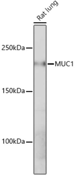 Invitrogen MUC1 Recombinant Rabbit Monoclonal Antibody (2M3D5) 100 &mu;L;