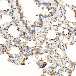 Invitrogen MyD88 Recombinant Rabbit Monoclonal Antibody (9R10V8) 100 &mu;L | Buy Online | Invitrogen&trade; | Fisher Scientific