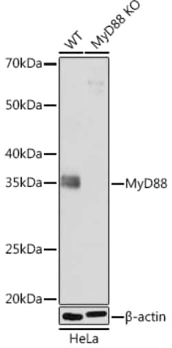 Invitrogen MyD88 Recombinant Rabbit Monoclonal Antibody (9R10V8) 100 &mu;L | Buy Online | Invitrogen&trade; | Fisher Scientific