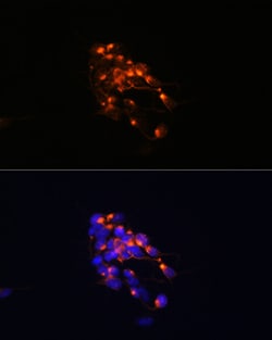 Invitrogen NEFM Recombinant Rabbit Monoclonal Antibody (5E0D2) 100 &mu;L;