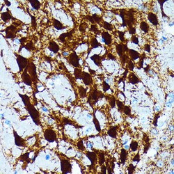 Invitrogen Parvalbumin Recombinant Rabbit Monoclonal Antibody (6C7K6) 100 &mu;L | Buy Online | Invitrogen&trade; | Fisher Scientific