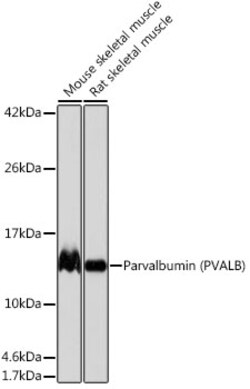 Invitrogen Parvalbumin Recombinant Rabbit Monoclonal Antibody (6C7K6) 100 &mu;L | Buy Online | Invitrogen&trade; | Fisher Scientific