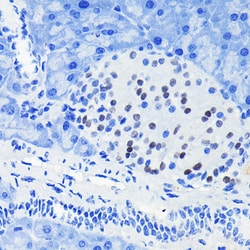 Invitrogen PAX6 Recombinant Rabbit Monoclonal Antibody (9O9E1) 100 &mu;L;