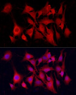 Invitrogen PGP9.5 Recombinant Rabbit Monoclonal Antibody (4F10B1) 100 &mu;L;