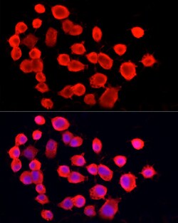 Invitrogen PGP9.5 Recombinant Rabbit Monoclonal Antibody (4F10B1) 100 &mu;L;