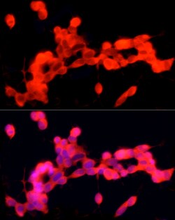 Invitrogen PGP9.5 Recombinant Rabbit Monoclonal Antibody (4F10B1) 100 &mu;L;
