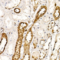 Invitrogen PGP9.5 Recombinant Rabbit Monoclonal Antibody (4F10B1) 100 &mu;L;