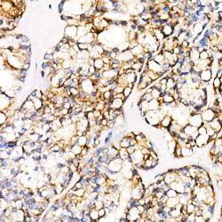 Invitrogen PGP9.5 Recombinant Rabbit Monoclonal Antibody (4F10B1) 100 &mu;L;