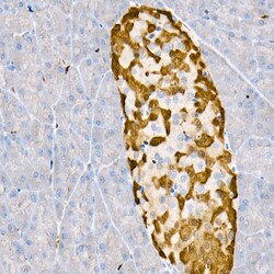 Invitrogen PGP9.5 Recombinant Rabbit Monoclonal Antibody (4F10B1) 100 &mu;L;