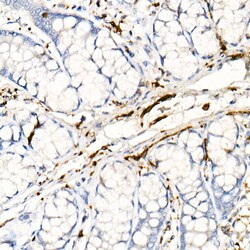 Invitrogen PGP9.5 Recombinant Rabbit Monoclonal Antibody (4F10B1) 100 &mu;L;