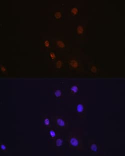 Invitrogen S100A4 Recombinant Rabbit Monoclonal Antibody (8R2W0) 100 &mu;L | Buy Online | Invitrogen&trade; | Fisher Scientific