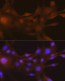 Invitrogen S100A4 Recombinant Rabbit Monoclonal Antibody (8R2W0) 100 &mu;L | Buy Online | Invitrogen&trade; | Fisher Scientific