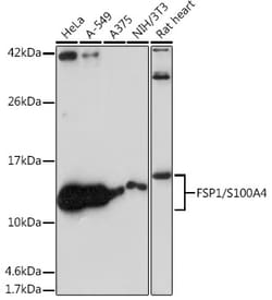 Invitrogen S100A4 Recombinant Rabbit Monoclonal Antibody (8R2W0) 100 &mu;L | Buy Online | Invitrogen&trade; | Fisher Scientific