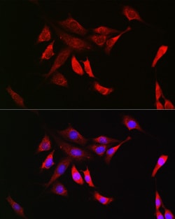 Invitrogen SHP2 Recombinant Rabbit Monoclonal Antibody (3Q4U2) 100 &mu;L;