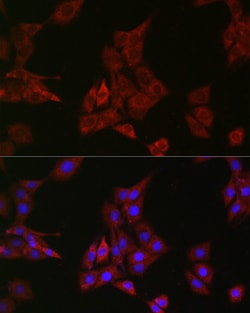 Invitrogen SHP2 Recombinant Rabbit Monoclonal Antibody (3Q4U2) 100 &mu;L;